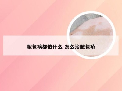 脓包病都怕什么 怎么治脓包疮