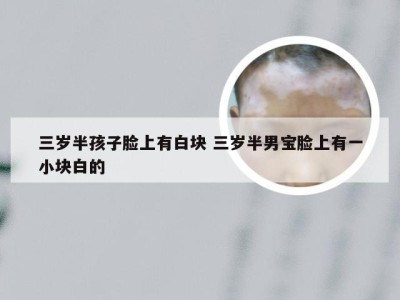 三岁半孩子脸上有白块 三岁半男宝脸上有一小块白的