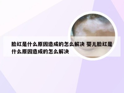 脸红是什么原因造成的怎么解决 婴儿脸红是什么原因造成的怎么解决