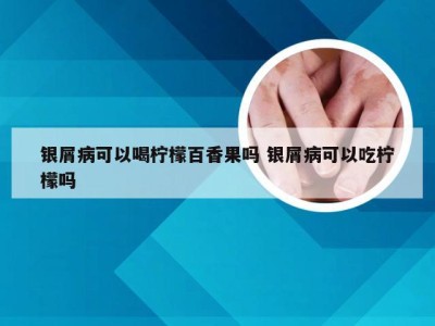 银屑病可以喝柠檬百香果吗 银屑病可以吃柠檬吗