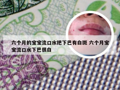 六个月的宝宝流口水把下巴有白斑 六个月宝宝流口水下巴很白