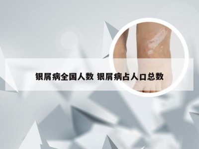 银屑病全国人数 银屑病占人口总数