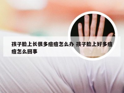 孩子脸上长很多痘痘怎么办 孩子脸上好多痘痘怎么回事