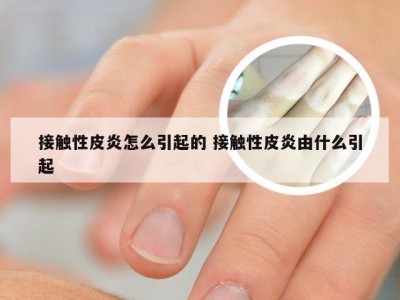 接触性皮炎怎么引起的 接触性皮炎由什么引起