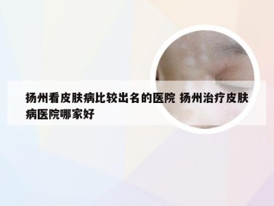 扬州看皮肤病比较出名的医院 扬州治疗皮肤病医院哪家好