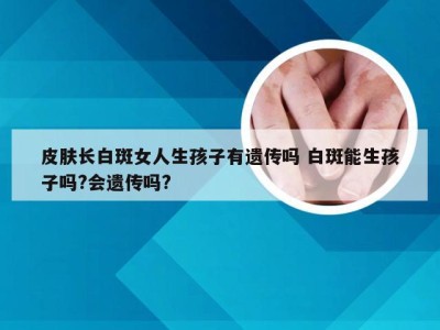 皮肤长白斑女人生孩子有遗传吗 白斑能生孩子吗?会遗传吗?