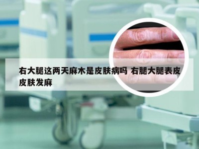 右大腿这两天麻木是皮肤病吗 右腿大腿表皮皮肤发麻