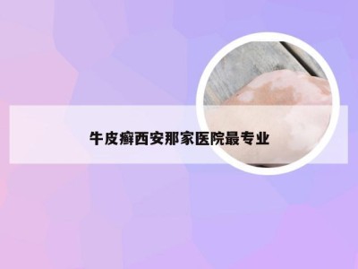 牛皮癣西安那家医院最专业