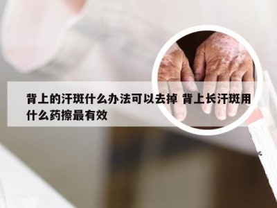 背上的汗斑什么办法可以去掉 背上长汗斑用什么药擦最有效