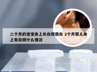 二个月的宝宝身上长白斑很白 2个月婴儿身上有白斑什么情况