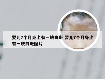 婴儿7个月身上有一块白斑 婴儿7个月身上有一块白斑图片