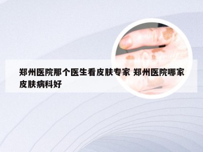 郑州医院那个医生看皮肤专家 郑州医院哪家皮肤病科好