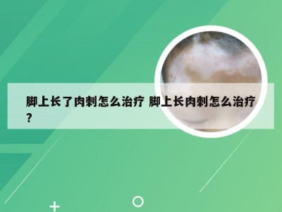 脚上长了肉刺怎么治疗 脚上长肉刺怎么治疗?