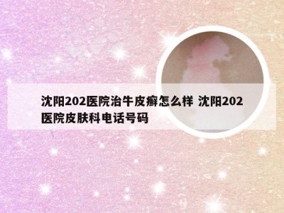 沈阳202医院治牛皮癣怎么样 沈阳202医院皮肤科电话号码