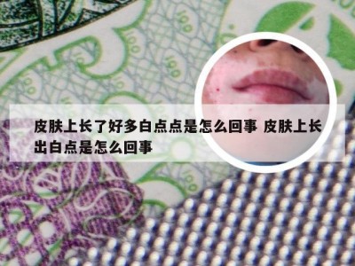 皮肤上长了好多白点点是怎么回事 皮肤上长出白点是怎么回事