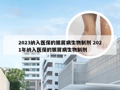 2023纳入医保的银屑病生物制剂 2021年纳入医保的银屑病生物制剂