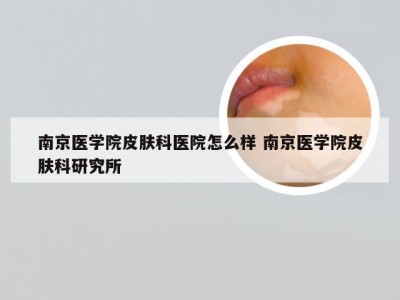 南京医学院皮肤科医院怎么样 南京医学院皮肤科研究所