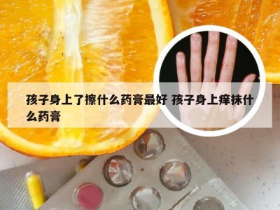 孩子身上了擦什么药膏最好 孩子身上痒抹什么药膏