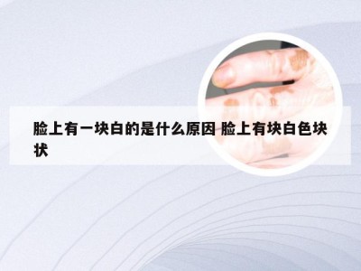 脸上有一块白的是什么原因 脸上有块白色块状