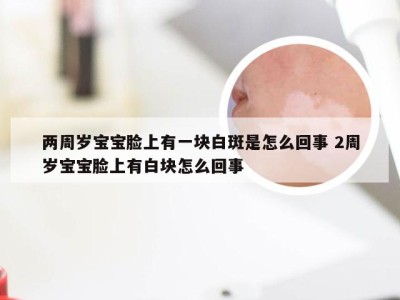 两周岁宝宝脸上有一块白斑是怎么回事 2周岁宝宝脸上有白块怎么回事