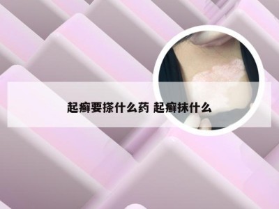 起癣要搽什么药 起癣抹什么