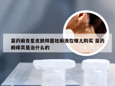 苗药癣克星皮肤抑菌祛癣液在哪儿购买 苗药癣痒灵是治什么的