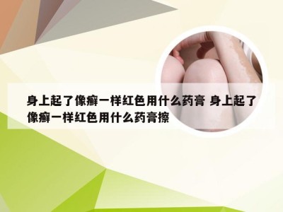 身上起了像癣一样红色用什么药膏 身上起了像癣一样红色用什么药膏擦