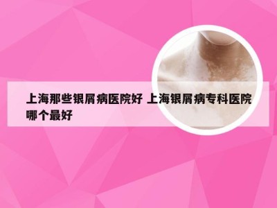 上海那些银屑病医院好 上海银屑病专科医院哪个最好