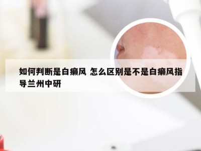 如何判断是白癞风 怎么区别是不是白癞风指导兰州中研