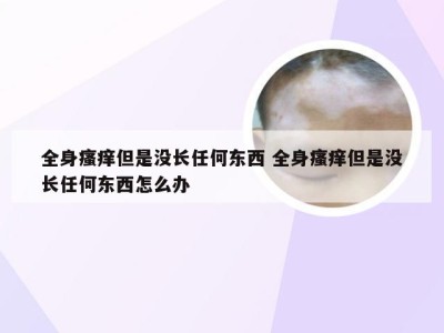 全身瘙痒但是没长任何东西 全身瘙痒但是没长任何东西怎么办