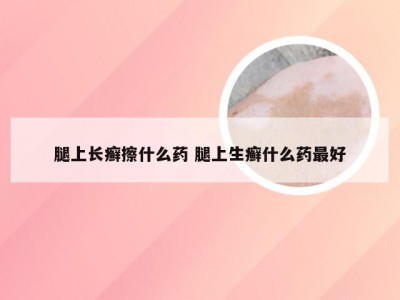 腿上长癣擦什么药 腿上生癣什么药最好