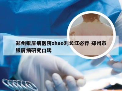 郑州银屑病医院zhao刘长江必荐 郑州市银屑病研究口碑