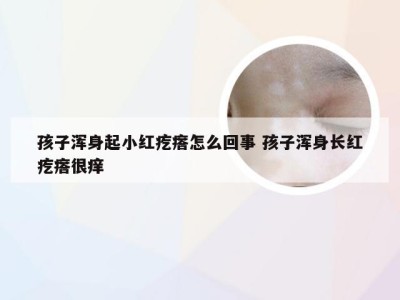 孩子浑身起小红疙瘩怎么回事 孩子浑身长红疙瘩很痒