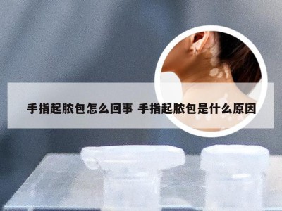 手指起脓包怎么回事 手指起脓包是什么原因