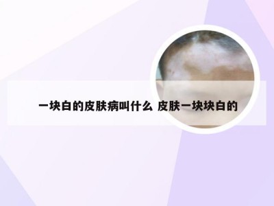 一块白的皮肤病叫什么 皮肤一块块白的