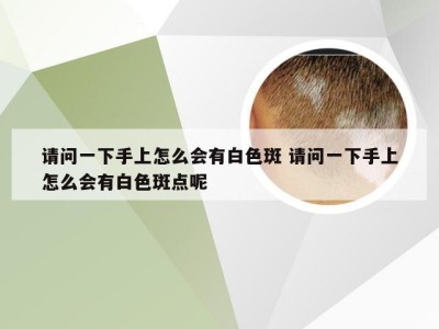 请问一下手上怎么会有白色斑 请问一下手上怎么会有白色斑点呢