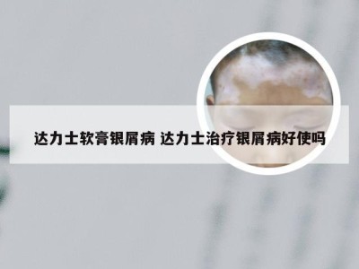 达力士软膏银屑病 达力士治疗银屑病好使吗