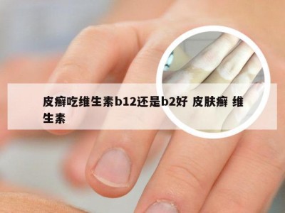 皮癣吃维生素b12还是b2好 皮肤癣 维生素