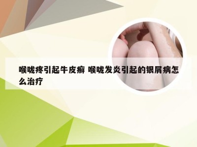 喉咙疼引起牛皮癣 喉咙发炎引起的银屑病怎么治疗