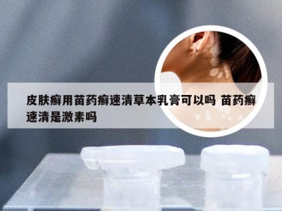 皮肤癣用苗药癣速清草本乳膏可以吗 苗药癣速清是激素吗