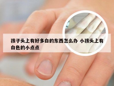 孩子头上有好多白的东西怎么办 小孩头上有白色的小点点