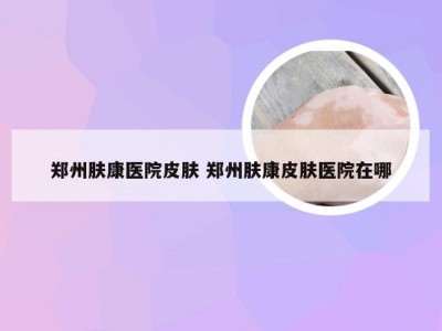 郑州肤康医院皮肤 郑州肤康皮肤医院在哪