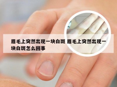 眉毛上突然出现一块白斑 眉毛上突然出现一块白斑怎么回事