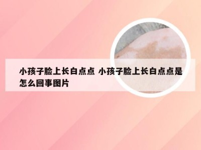 小孩子脸上长白点点 小孩子脸上长白点点是怎么回事图片