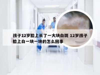 孩子12岁脸上长了一大块白斑 12岁孩子脸上白一块一块的怎么回事