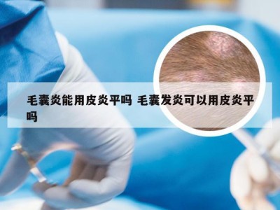 毛囊炎能用皮炎平吗 毛囊发炎可以用皮炎平吗