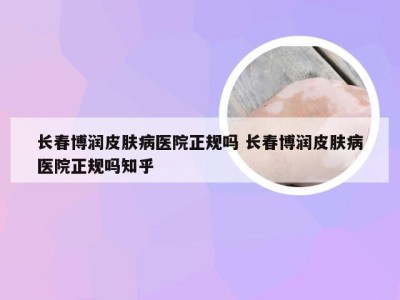 长春博润皮肤病医院正规吗 长春博润皮肤病医院正规吗知乎