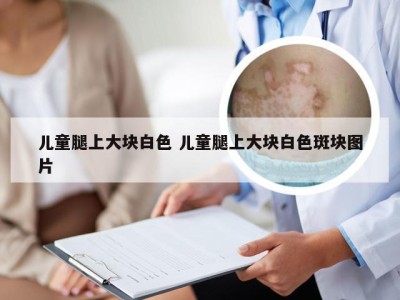 儿童腿上大块白色 儿童腿上大块白色斑块图片