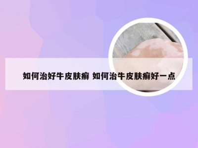 如何治好牛皮肤癣 如何治牛皮肤癣好一点