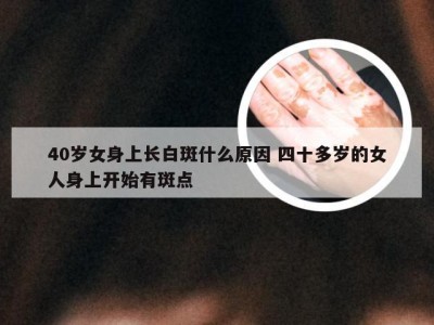 40岁女身上长白斑什么原因 四十多岁的女人身上开始有斑点